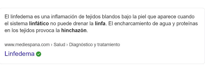 Medias de compresión para viajar en avión